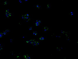 PIM2 / Pim-2 Antibody - Immunofluorescent staining of HepG2 cells using anti-PIM2 mouse monoclonal antibody.