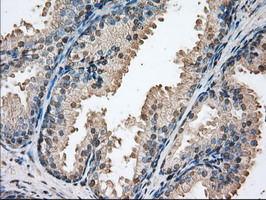 PIM2 / Pim-2 Antibody - IHC of paraffin-embedded Human liver tissue using anti-PIM2 mouse monoclonal antibody. (Dilution 1:50).