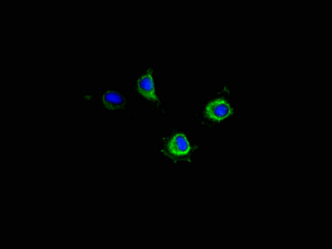 PIM2 / Pim-2 Antibody - Immunofluorescent analysis of Hela cells using PIM2 Antibody at a dilution of 1:100 and Alexa Fluor 488-congugated AffiniPure Goat Anti-Rabbit IgG(H+L)