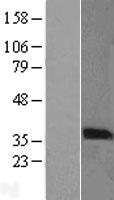 PIM2 / Pim-2 Protein - Western validation with an anti-DDK antibody * L: Control HEK293 lysate R: Over-expression lysate