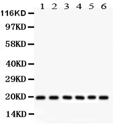 PIN1 Antibody - PIN1 antibody Western blot. All lanes: Anti PIN1 at 0.5 ug/ml. Lane 1: Rat Lung Tissue Lysate at 50 ug. Lane 2: Mouse Lung Tissue Lysate at 50 ug. Lane 3: NRK Whole Cell Lysate at 40 ug. Lane 4: A549 Whole Cell Lysate at 40 ug. Lane 5: 293T Whole Cell Lysate at 40 ug. Lane 6: MCF-7 Whole Cell Lysate at 40 ug. Predicted band size: 19 kD. Observed band size: 19 kD.