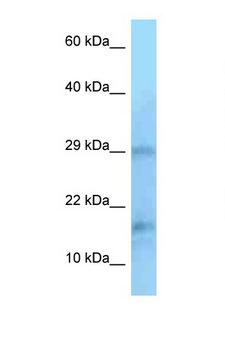 PIN1 Antibody - PIN1 antibody Western blot of Jurkat Cell lysate. Antibody concentration 1 ug/ml.  This image was taken for the unconjugated form of this product. Other forms have not been tested.