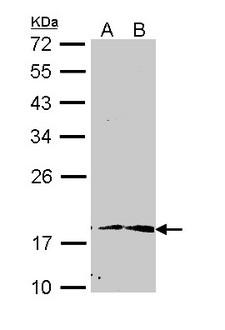 PIN1 Antibody - Sample (30 ug of whole cell lysate). A: Hep G2. B: Raji. 12% SDS PAGE. PIN1 antibody diluted at 1:1000. 