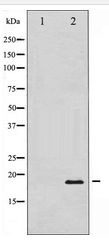 PIN1 Antibody - Western blot of Pin1 expression in COS7 whole cell lysates,The lane on the left is treated with the antigen-specific peptide.