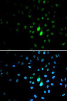 PIN1 Antibody - Immunofluorescence analysis of MCF-7 cells using PIN1 antibody. Blue: DAPI for nuclear staining.