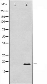 PIN1 Antibody - Western blot analysis of Pin1 expression in COS7 whole cells lysates. The lane on the left is treated with the antigen-specific peptide.