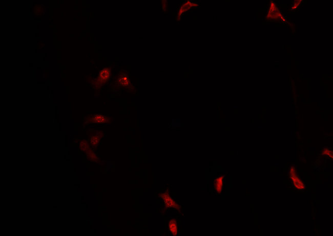 PIN1 Antibody - Staining COS7 cells by IF/ICC. The samples were fixed with PFA and permeabilized in 0.1% Triton X-100, then blocked in 10% serum for 45 min at 25°C. The primary antibody was diluted at 1:200 and incubated with the sample for 1 hour at 37°C. An Alexa Fluor 594 conjugated goat anti-rabbit IgG (H+L) Ab, diluted at 1/600, was used as the secondary antibody.