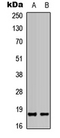 PIN1 Antibody - Western blot analysis of PIN1 expression in HepG2 (A); Raji (B) whole cell lysates.