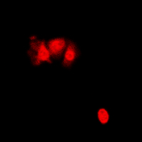 PIN1 Antibody - Immunofluorescent analysis of PIN1 staining in HepG2 cells. Formalin-fixed cells were permeabilized with 0.1% Triton X-100 in TBS for 5-10 minutes and blocked with 3% BSA-PBS for 30 minutes at room temperature. Cells were probed with the primary antibody in 3% BSA-PBS and incubated overnight at 4 deg C in a humidified chamber. Cells were washed with PBST and incubated with a DyLight 594-conjugated secondary antibody (red) in PBS at room temperature in the dark. DAPI was used to stain the cell nuclei (blue).