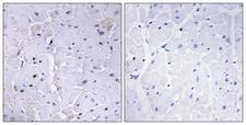 PIN1 Antibody - Immunohistochemistry analysis of paraffin-embedded human heart, using Pin1 (Phospho-Ser16) Antibody. The picture on the right is blocked with the phospho peptide.