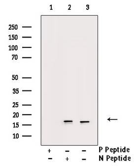 PIN1 Antibody - Western blot analysis of Phospho-Pin1 (Ser16) antibody expression in Insulin treated COS7 cells lysates. The lane on the right is treated with the antigen-specific peptide.