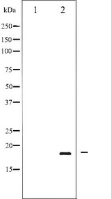 PIN1 Antibody - Western blot analysis of Pin1 phosphorylation expression in Insulin treated COS7 whole cells lysates. The lane on the left is treated with the antigen-specific peptide.
