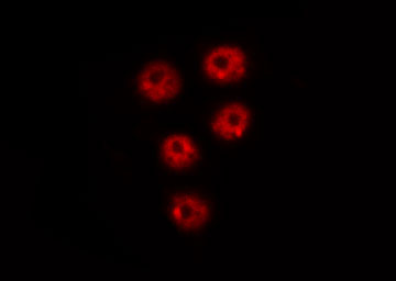 PIN1 Antibody - Staining COS7 cells by IF/ICC. The samples were fixed with PFA and permeabilized in 0.1% Triton X-100, then blocked in 10% serum for 45 min at 25°C. The primary antibody was diluted at 1:200 and incubated with the sample for 1 hour at 37°C. An Alexa Fluor 594 conjugated goat anti-rabbit IgG (H+L) Ab, diluted at 1/600, was used as the secondary antibody.