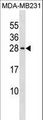 PIN4 Antibody - PIN4 Antibody western blot of MDA-MB231 cell line lysates (35 ug/lane). The PIN4 antibody detected the PIN4 protein (arrow).