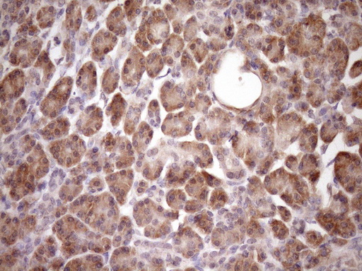 PIN4 Antibody - Immunohistochemical staining of paraffin-embedded Human pancreas tissue within the normal limits using anti-PIN4 mouse monoclonal antibody. (Heat-induced epitope retrieval by Tris-EDTA, pH8.0)(1:150)