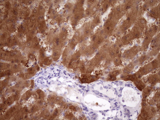 PIN4 Antibody - Immunohistochemical staining of paraffin-embedded Human liver tissue within the normal limits using anti-PIN4 mouse monoclonal antibody. (Heat-induced epitope retrieval by Tris-EDTA, pH8.0)(1:150)