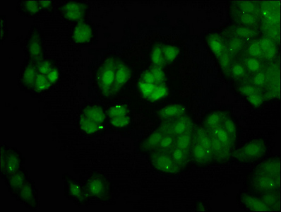 PIN4 Antibody - Immunofluorescence staining of HepG2 cells at a dilution of 1:266, counter-stained with DAPI. The cells were fixed in 4% formaldehyde, permeabilized using 0.2% Triton X-100 and blocked in 10% normal Goat Serum. The cells were then incubated with the antibody overnight at 4 °C.The secondary antibody was Alexa Fluor 488-congugated AffiniPure Goat Anti-Rabbit IgG (H+L) .