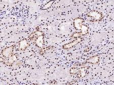 PIN4 Antibody - Immunochemical staining of human PIN4 in human kidney with rabbit polyclonal antibody at 1:1000 dilution, formalin-fixed paraffin embedded sections.