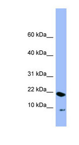 PIN4 Antibody - PIN4 antibody Western blot of 293T cell lysate. This image was taken for the unconjugated form of this product. Other forms have not been tested.