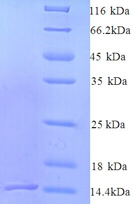 N16.1 Matrix Protein Protein
