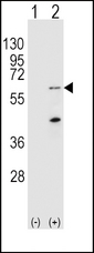 PINK1 Antibody - Western blot of Park6(PINK1) (arrow) using rabbit polyclonal Park6(PINK1) Antibody. 293 cell lysates (2 ug/lane) either nontransfected (Lane 1) or transiently transfected (Lane 2) with the Park6(PINK1) gene.