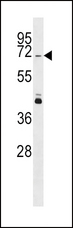 PINK1 Antibody - Park6 (PINK1) Antibody western blot of MCF-7 cell line lysates (35 ug/lane). The Park6 (PINK1) antibody detected the Park6 (PINK1) protein (arrow).