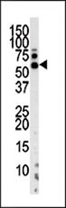 PINK1 Antibody - Western blot of anti-PARK6 antibody in mouse kidney tissue lysate. PARK6 (arrow) was detected using the purified antibody.