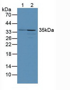 PINK1 Antibody - Western Blot; Lane1: Human Serum; Lane2: Mouse Heart Tissue.