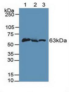 PINK1 Antibody - Western Blot; Sample: Lane1: Mouse Liver Tissue; Lane2: Mouse Testis Tissue; Lane3: Mouse Brain Tissue.
