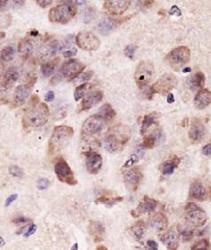 PINK1 Antibody - PINK1 Antibody - PINK1 stain in paraffin embedded mouse brain..  This image was taken for the unconjugated form of this product. Other forms have not been tested.