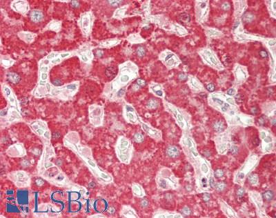 PINK1 Antibody - Human Liver: Formalin-Fixed, Paraffin-Embedded (FFPE).  This image was taken for the unconjugated form of this product. Other forms have not been tested.