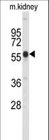 PINK1 Antibody - Western blot of Park6 (PINK1) C-term in mouse kidney tissue lysates (35 ug/lane). Park6 (arrow) was detected using the purified antibody.