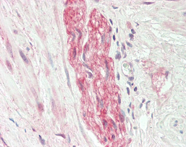 PINK1 Antibody - Human Prostate, Nerve: Formalin-Fixed, Paraffin-Embedded (FFPE).  This image was taken for the unconjugated form of this product. Other forms have not been tested.