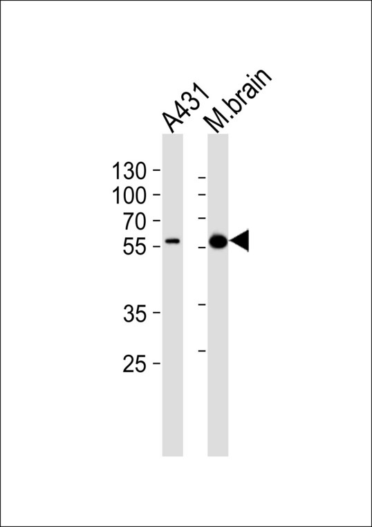 PINK1 Antibody - Western blot of lysates from A431 cell line , mouse brain tissue lysate(from left to right), using Pink1 Antibody(115-213). Antibody was diluted at 1:1000 at each lane. A goat anti-rabbit IgG H&L (HRP) at 1:10000 dilution was used as the secondary antibody. Lysates at 20ug per lane.