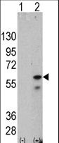 PINK1 Antibody - Western blot of PINK (arrow) using mouse monoclonal PINK antibody. 293 cell lysates (2 ug/lane) either nontransfected (Lane 1) or transiently transfected with the PINK gene (Lane 2) (Origene Technologies)
