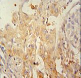 PINK1 Antibody - PINK1 Monoclonal Antibody immunohistochemistry of formalin-fixed and paraffin-embedded human kidney tissue followed by peroxidase-conjugated secondary antibody and DAB staining.
