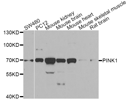 PINK1 Antibody - Western blot of extracts of various cell lines, using PINK1 antibody.