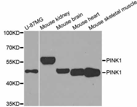 PINK1 Antibody - Western blot analysis of extracts of various cell lines.