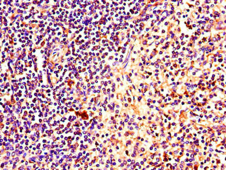 PINK1 Antibody - Immunohistochemistry of paraffin-embedded human spleen tissue using PINK1 Antibody at dilution of 1:100