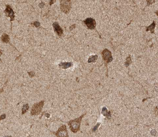 PINK1 Antibody - 1:50 staining human brain tissue by IHC-P. The tissue was formaldehyde fixed and a heat mediated antigen retrieval step in citrate buffer was performed. The tissue was then blocked and incubated with the antibody for 1.5 hours at 22°C. An HRP conjugated goat anti-rabbit antibody was used as the secondary.