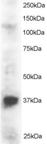 PINX1 Antibody - Antibody staining (2 ug/ml) of Jurkat lysate (RIPA buffer, 30 ug total protein per lane). Primary incubated for 1 hour. Detected by Western blot of chemiluminescence.