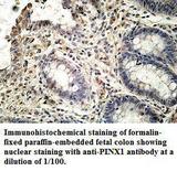 PINX1 Antibody