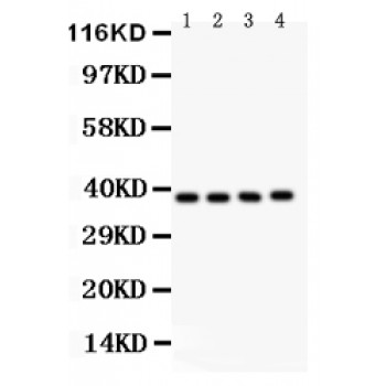 PINX1 Antibody - PINX1 antibody Western blot. All lanes: Anti PINX1 at 0.5 ug/ml. Lane 1: Human Placenta Tissue Lysate at 50 ug. Lane 2: HELA Whole Cell Lysate at 40 ug. Lane 3: HUT Whole Cell Lysate at 40 ug. Lane 4: JURKAT Whole Cell Lysate at 40 ug. Predicted band size: 37 kD. Observed band size: 37 kD.