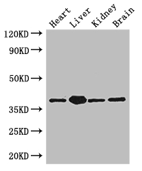 PINX1 Antibody - Positive WB detected in:Mouse heart tissue,Mouse liver tissue,Mouse kidney tissue,Mouse brain tissue;All lanes: PINX1 antibody at 3.4ug/ml;Secondary;Goat polyclonal to rabbit IgG at 1/50000 dilution;Predicted band size: 38,20 kDa;Observed band size: 38 kDa;