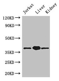 PINX1 Antibody - Western Blot Positive WB detected in: Jurkat whole cell lysate, Mouse liver tissue, Mouse kidney tissue All lanes: PINX1 antibody at 3.4µg/ml Secondary Goat polyclonal to rabbit IgG at 1/50000 dilution Predicted band size: 38, 20 kDa Observed band size: 38 kDa