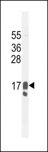 PIP / GCDFP-15 Antibody - GCDFP-15 Antibody western blot of MDA-MB231 cell line lysates (35 ug/lane). The GCDFP-15 antibody detected the GCDFP-15 protein (arrow).