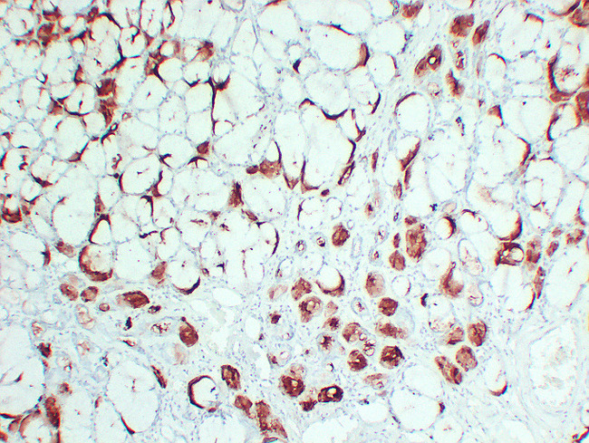 PIP / GCDFP-15 Antibody - Salivary Gland