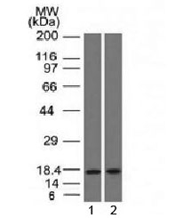 PIP / GCDFP-15 Antibody - Western blot testing of human 1) pancreas and 2) HepG2 lysate with PIP antibody (clone PIP/1571). Expected molecular weight ~15 kDa.