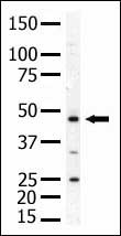 PIP4K2A / PIPK Antibody - The anti-PIP5K2A antibody is used in Western blot to detect PIP5K2A in mouse skeletal muscle tissue lysate.