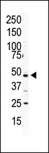 PIP4K2A / PIPK Antibody - Western blot of anti-PIP5K2A antibody in HL60 cell lysate. PIP5K2A (arrow) was detected using purified antibody. Secondary HRP-anti-rabbit was used for signal visualization with chemiluminescence.